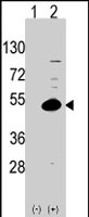 PAB2546 - NR0B1