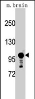 PAB2549 - SEMA5A