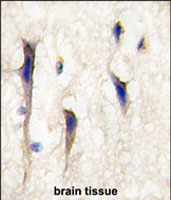 PAB2551 - ARHGEF9