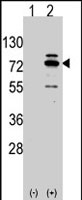 PAB2551 - ARHGEF9