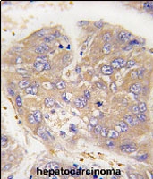 PAB2552 - Dysbindin