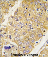 PAB2553 - Dysbindin