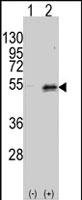 PAB2553 - Dysbindin