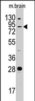 PAB2555 - Junctophilin-3 / JPH3