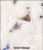 PAB2555 - Junctophilin-3 / JPH3