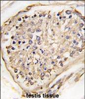 PAB2556 - Neuronal pentraxin-2