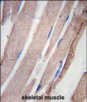 PAB2560 - PHPT1