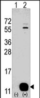 PAB2560 - PHPT1