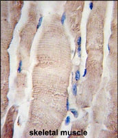 PAB2561 - PHPT1