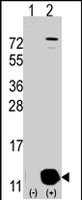 PAB2561 - PHPT1