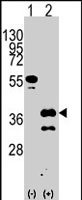PAB2562 - ZIC4