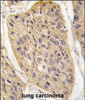PAB2563 - WIF1