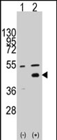 PAB2563 - WIF1