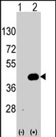 PAB2564 - WIF1