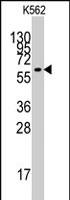 PAB2567 - KLF4