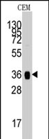 PAB2568 - Aldolase A / ALDOA