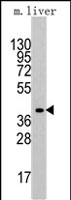 PAB2569 - Aldolase A / ALDOA