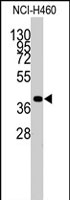 PAB2573 - Chondromodulin-1