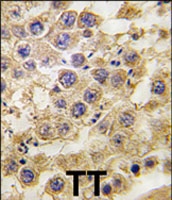 PAB2574 - NANOS2