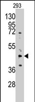 PAB2577 - AdoHcyase / AHCY