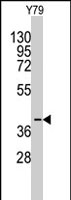 PAB2580 - AKR1A1 / ALDR1