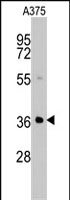 PAB2581 - AKR1B1 / ALDR1