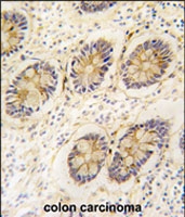 PAB2581 - AKR1B1 / ALDR1