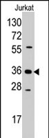 PAB2582 - AKR1B1 / ALDR1