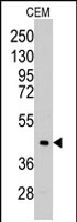 PAB2583 - Aldolase C / ALDOC