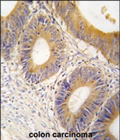 PAB2583 - Aldolase C / ALDOC