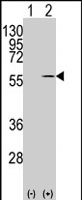 PAB2587 - Vimentin