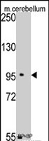 PAB2588 - SEMA6A