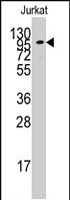 PAB2595 - Adenylate cyclase type 2
