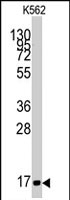 PAB2597 - MGST1