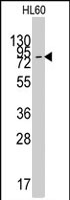 PAB2599 - SLC16A1