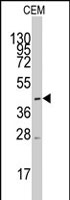 PAB2600 - SLC16A1
