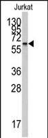 PAB2601 - CYP26A1