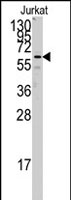 PAB2602 - FZD1 / Frizzled-1