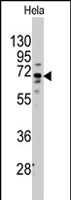 PAB2603 - FZD1 / Frizzled-1