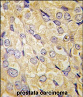 PAB2603 - FZD1 / Frizzled-1