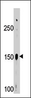 PAB2610 - ABL2