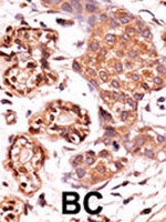 PAB2610 - ABL2