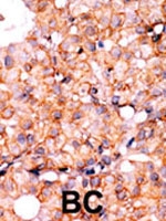 PAB2612 - AKT1 / PKB