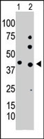 PAB2618 - Phosphoglycerate kinase 1 (PGK1)