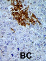 PAB2621 - PNCK
