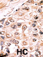 PAB2638 - Activin receptor type 1 / ACRV1