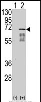 PAB2638 - Activin receptor type 1 / ACRV1