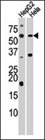 PAB2641 - Activin receptor type 1C / ACVR1C