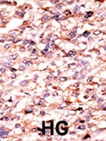 PAB2641 - Activin receptor type 1C / ACVR1C