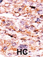 PAB2643 - Activin receptor type 2A / ACVR2A